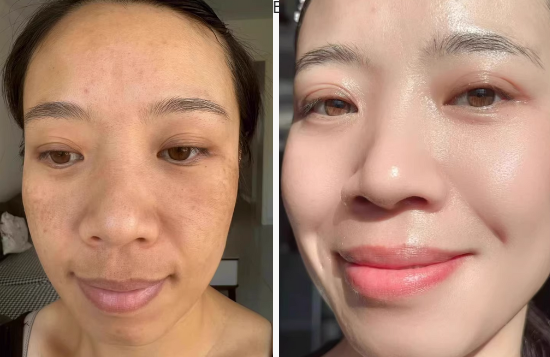 Aglaiwish  КРЕМ ПРОТИ ЗМОРШОК